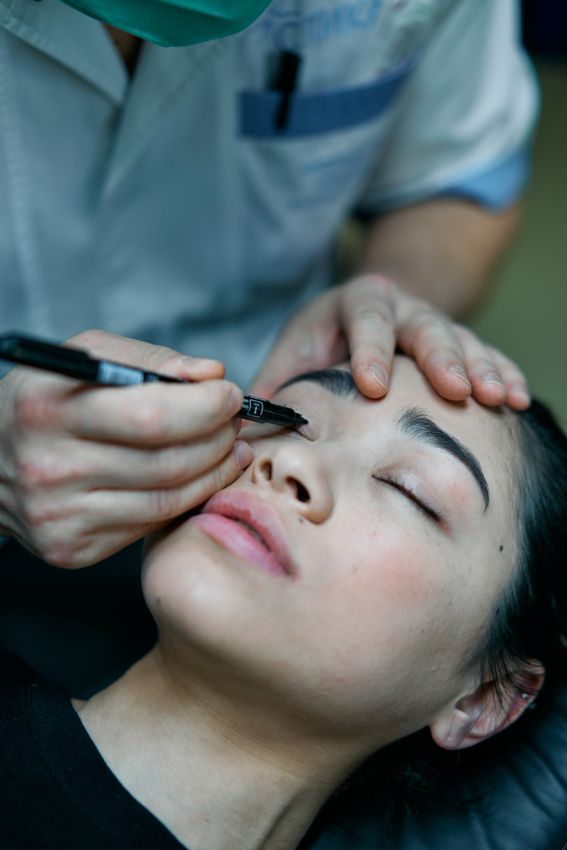 Close-up of an upper eyelid with surgical marking lines drawn before blepharoplasty