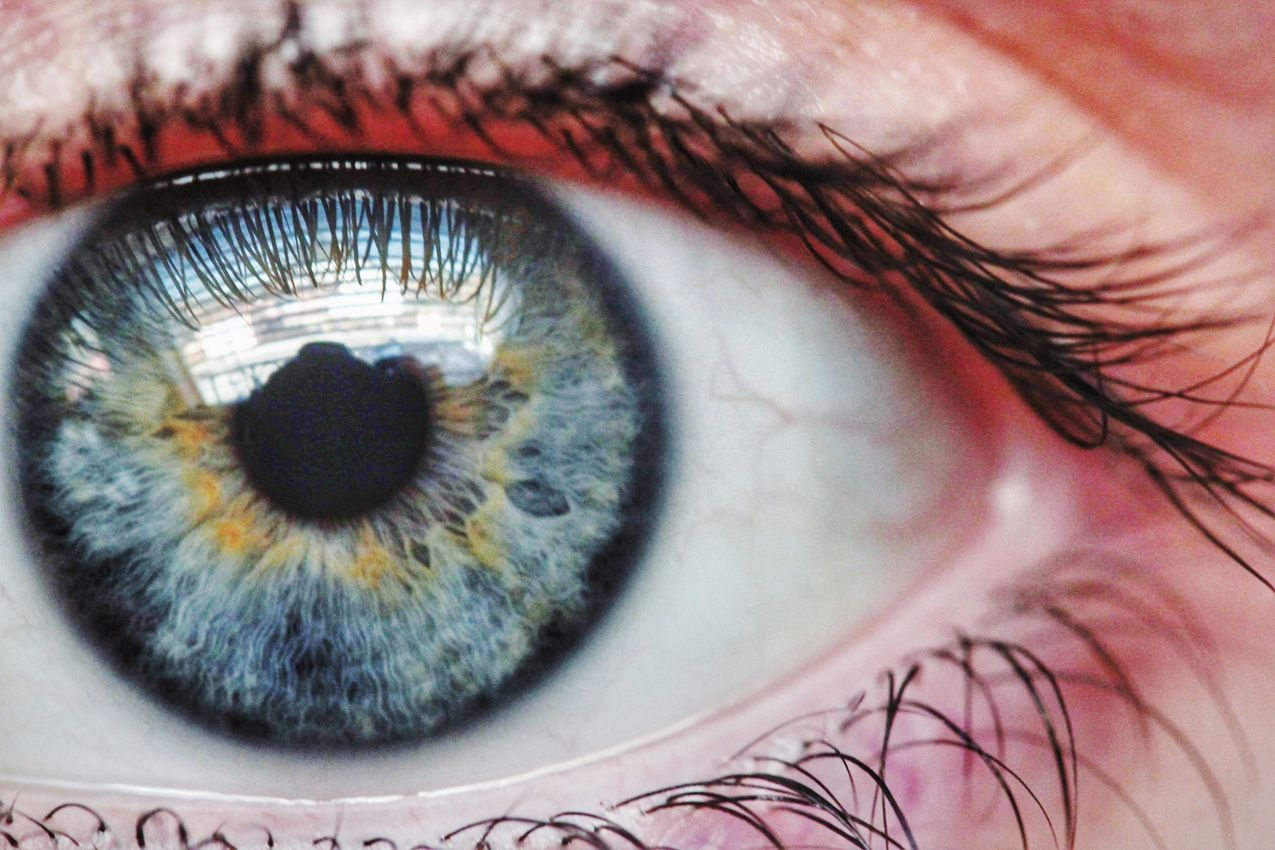 Limbal Kök Hücre İmplantasyonu